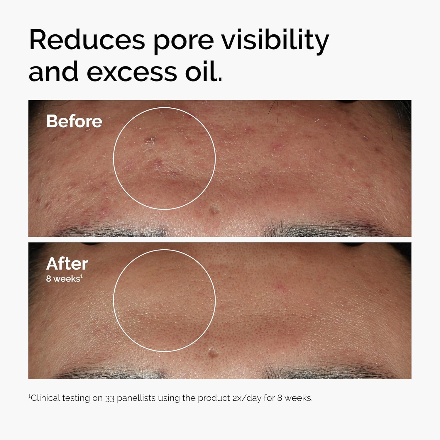 The Ordinary Niacinamide 10% + Zinc 1% 30ml - Image 3